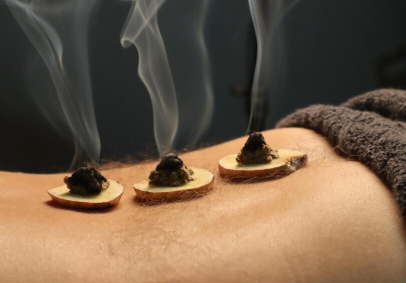 Additional support for postpartum recovery Postpartum acupuncture and moxibustion house call service in Denver Metro Areas, Boulder, Westminster, Arvada, Thornton, Aurora, Golden and surrounding communities in Colorado for hormonal balance.